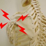 反復性肩関節脱臼での肩の痛み