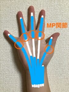 ばね指の起こりやすい中手指節関節(MP関節)を表した写真です。