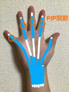 ばね指の二次的な影響で硬くなりやすい近位指節間関節(PIP関節)の場所を示した写真です。