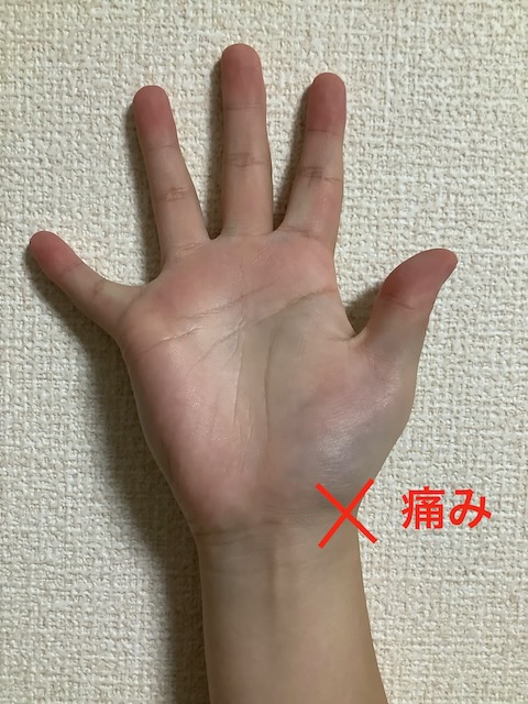 手首の親指側が痛くなる腱鞘炎を撓側手根屈筋腱炎といいます。マグカップ