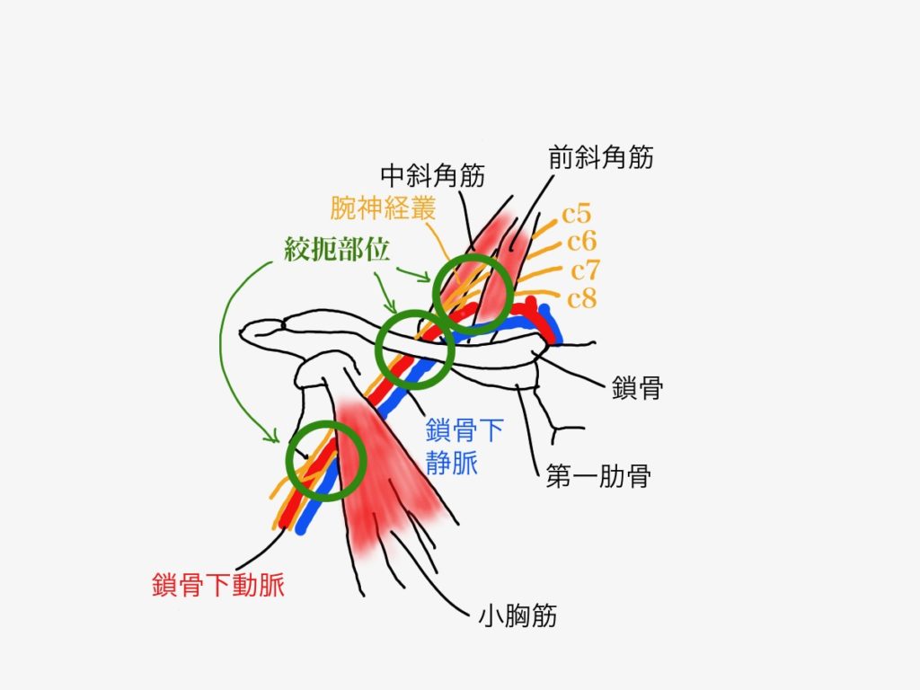 手のしびれ 腕の怠さの原因 胸郭出口症候群 頭痛 首こり 肩こり 変形性膝関節症 腱鞘炎 睡眠不足のお悩みはharmonia ハルモニア