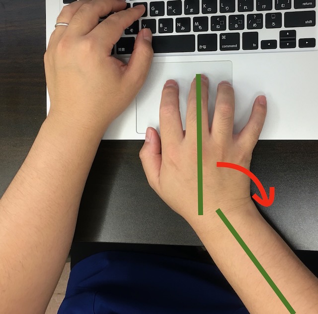 ノートパソコンでの作業でトラックパッドを使用していると手首が尺屈してしまい負担をかけやすく、腱鞘炎の原因となります。