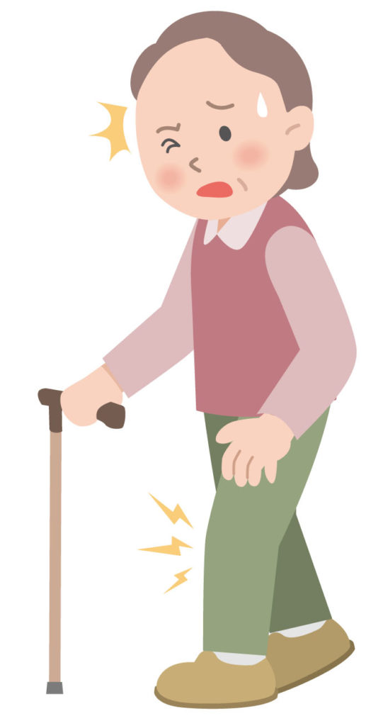変形性膝関節症に伴う歩行時の膝関節痛