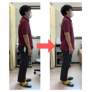 ストレスを抱えると猫背になり、首こり・肩こり・背中の痛みが出ていたのが、背筋が伸び首こり・肩こり・背中の痛みが無くなりました。