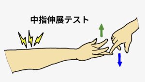 上腕骨外側上顆炎(テニス肘)を鑑別する方法の一つ、中指伸展テストです。検査者は、中指を押し下げ、被験者は肘を伸ばしたまま押されてる中指が曲がらないように耐えます。肘の外側に痛みが出たら陽性です。