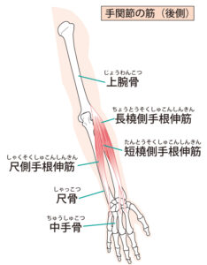 テニス肘が起こる原因となる炎症が起こりやすい長橈側手根伸筋、短橈側手根伸筋の位置を示しています。