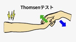 上腕骨外側上顆炎(テニス肘)を鑑別するThomsenテストです。検査者は手首を曲げようとし、被験者は肘を伸ばした状態で手首をかえすように力を入れます。肘の外側に痛みが出たら陽性と判断します。