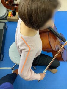 猫背・巻き肩になり肩甲骨が外転するとボウイングにおいて弓を引く動作で肩甲骨の内転動作が起きず、肩関節伸展が中心となることで、ボウイングにおける肩・肘・手首の連動性が崩れてしまう。