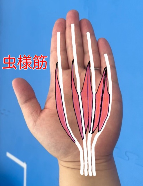 MP関節という指を曲げる関節の一つを動かす筋肉である虫様筋を表しています。