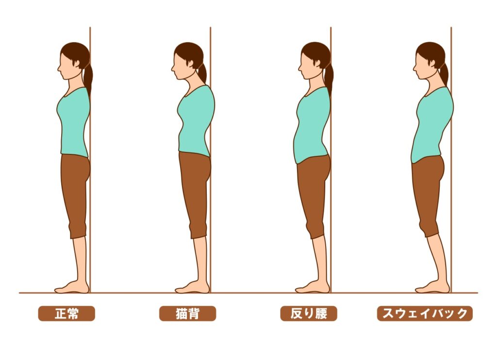 立ち姿勢(立位)での姿勢の崩れについて表した図です。左から正常・猫背・反り腰・スウェイバック姿勢を表しています。