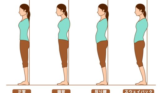 立ち姿勢(立位)での姿勢の崩れについて表した図です。左から正常・猫背・反り腰・スウェイバック姿勢を表しています。