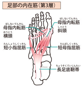外反母趾に影響がある母趾内転筋が記載されているイラストです。