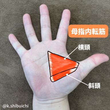 母指外転筋群を実際の手のひらに図示した写真です。