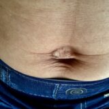 産後のぽっこりお腹、もしかして「腹直筋離開」かも?原因とセルフチェック、改善法を解説! 10 産後のお腹をの様子です。腹筋が伸びてしまい柔らかく人によってはたるみが出てきます。この状態は、妊娠前にあった腹筋が弱くなっていることを示しています。