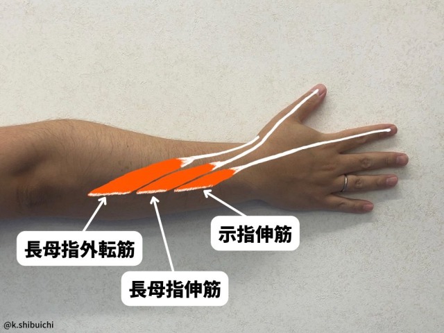 示指伸筋・長母指伸筋・長母指外転筋を実際の前腕に図示した右手の写真です。