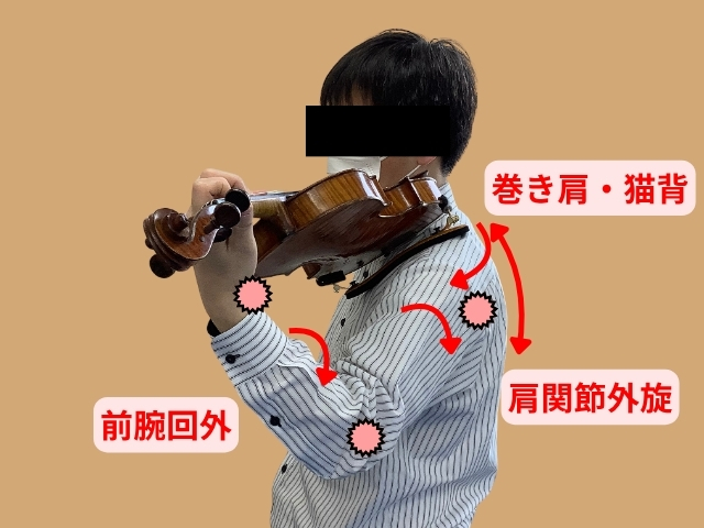 バイオリン奏者のしびれが起きる原因となる身体の動きについて